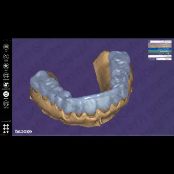 Exocad Bite Splint Module модуль для создания терапевтических капп