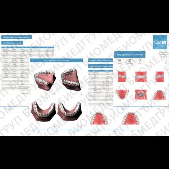 Ортодонтическое программное обеспечение Maestro 3D ortho