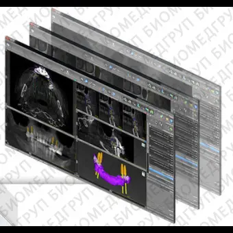 Программное обеспечение для стоматологической имплантологии coDiagnostic