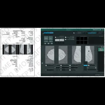 Информационная рабочая станция для маммографии ASPIRE Bellus II