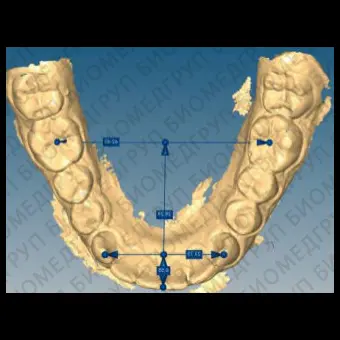 Программное обеспечение для стоматологии ORTHUP