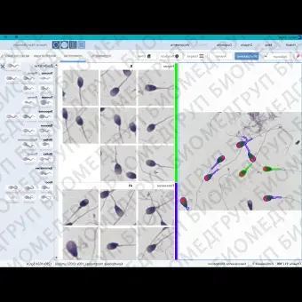 Спермоанализатор на базе ПО для компьютерного анализа эякулята, АргусCASA, АргусСофт, ARGUS  CASA 4