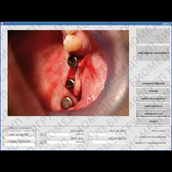 Модуль программного обеспечения для обработки снимков зубов Digitally Soft