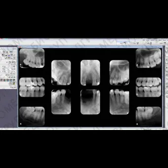 Программное обеспечение для обработки снимков зубов DBSWIN