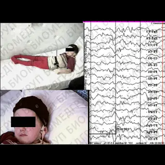 Монитор пациента RESP ENCEPHALANVIDEO