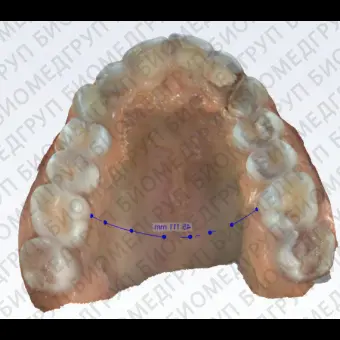 Программное обеспечение для обработки снимков зубов Planmeca Romexis 6.0