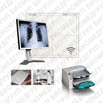 Система сбора данных для медицинских изображений для радиографии Retro Print