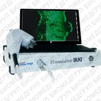 TPM DUB Digital Ultrasound Imaging System Дерматоскоп
