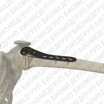 Компрессионная костная пластина плечевая кость 30708 series