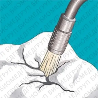 Sonicflex clean  набор насадок и щетки Sono для профессиональной механической чистки зубов снятия зубных отложений