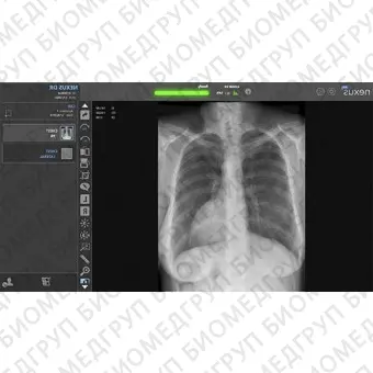 Система сбора данных для медицинских изображений для радиографии NexusDR
