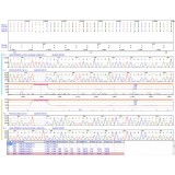 Программное обеспечение для последовательности оснований в ДНК Mutation Surveyor®