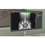 Система сбора данных для медицинских изображений для радиографии Nexus-DR™