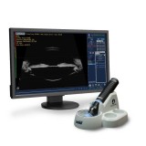 Переносной ультразвуковой сканер UBM Plus