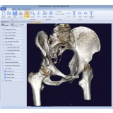 Программное обеспечение TDM mediCAD 3D Hip