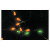 Набор LIVE/DEAD Sperm Viability Kit для флуор. анализа (цитометрия) жизнеспособности клеток сперматозоидов, Thermo FS, L7011, 100 мл