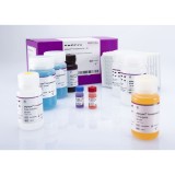Набор реагентов pigtype® Toxoplasma Ab для обнаружения токсоплазмоза методом ИФА(5 планшетов)