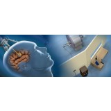 Устройство для лазерной абляции для лечения опухолей мозга NeuroBlate®