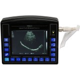 Переносной ультразвуковой сканер AV-2100